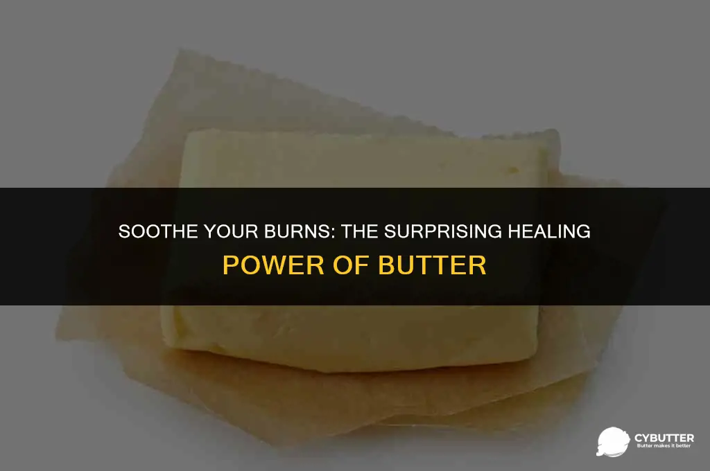 can butter help a burn