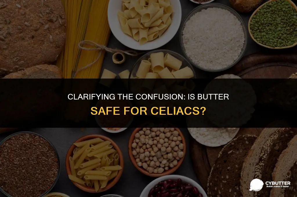 can celiac eat butter