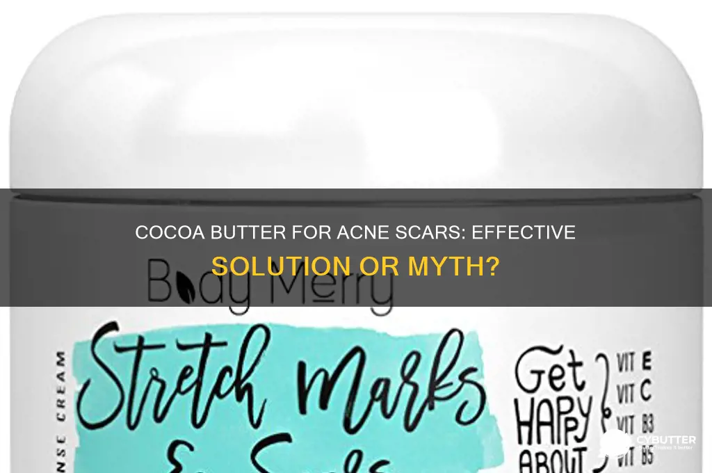can cocoa butter get rid of acne scars