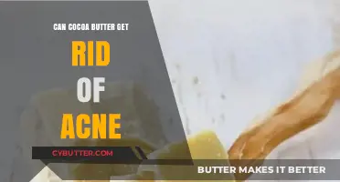Cocoa Butter for Acne: Does It Clear Skin or Cause Breakouts?