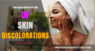 Cocoa Butter for Skin Discoloration: Effective Solution or Myth?