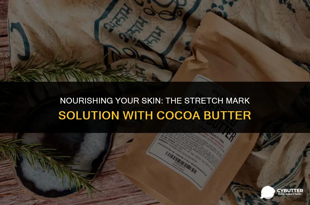 can cocoa butter help with stretch marks