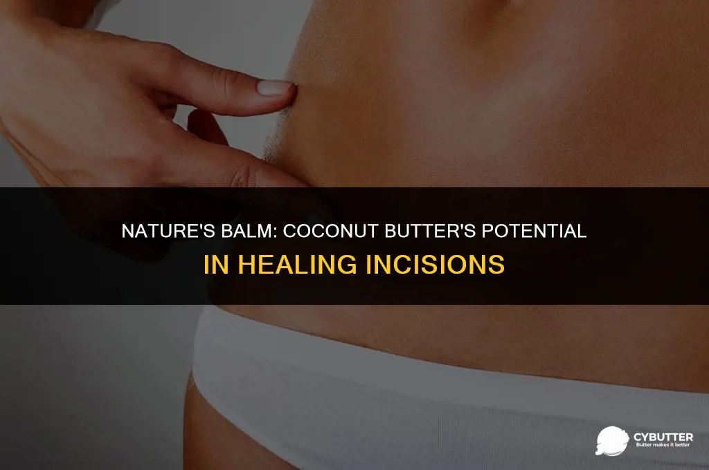 can coconut butter be used to help heal incisions