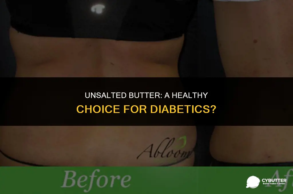 can diabetics eat unsalted butter