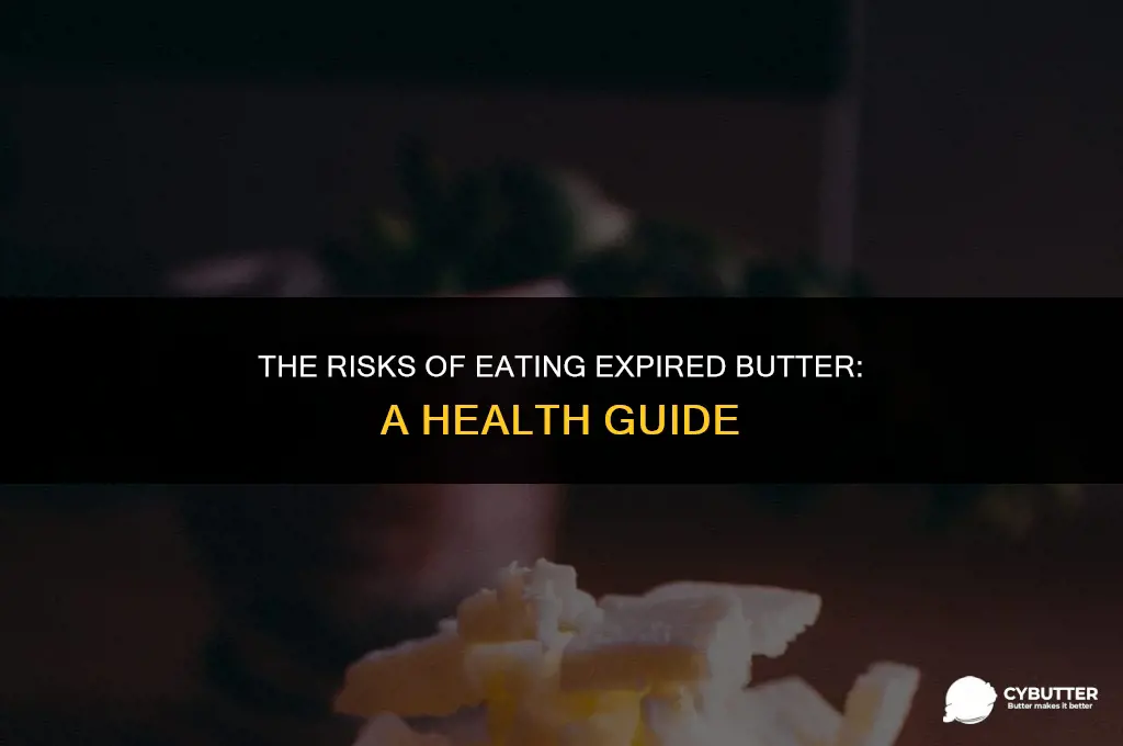 can expired butter make you sick