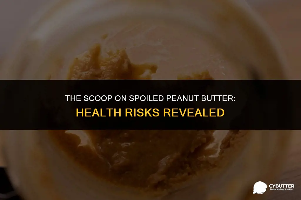 can expired peanut butter make you sick