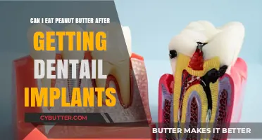 Peanut Butter and Dental Implants: Safe to Eat Post-Surgery?