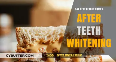 Peanut Butter Cravings Post-Teeth Whitening: What You Need to Know