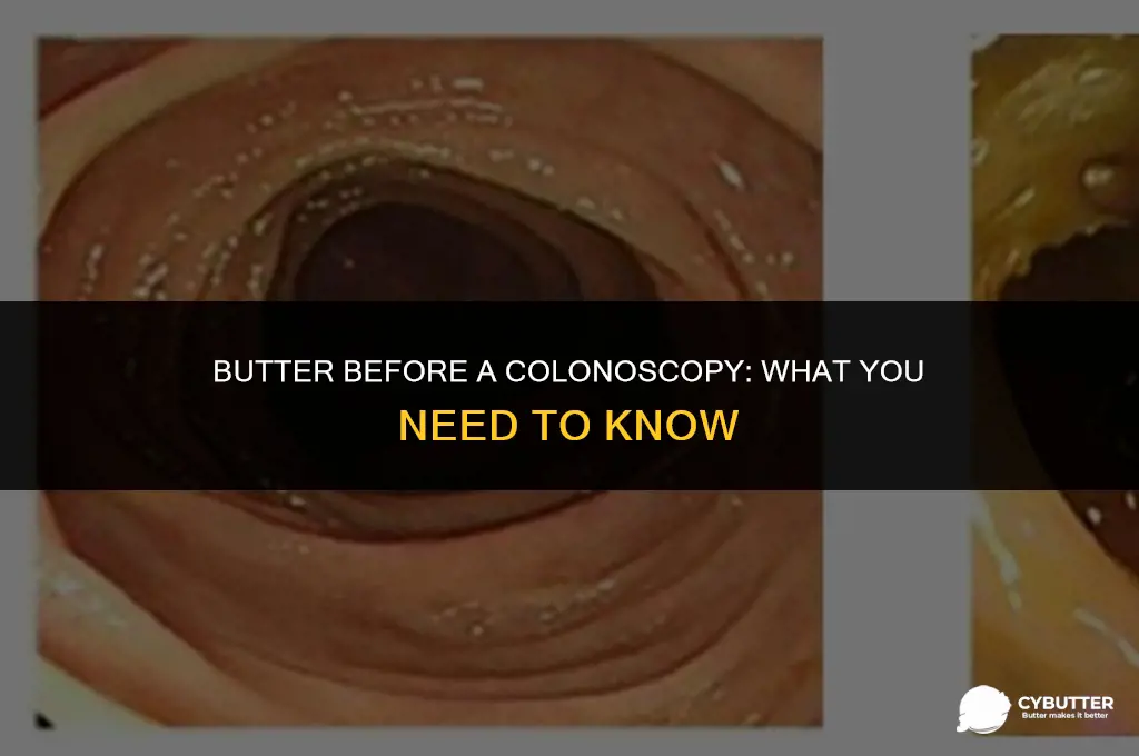 can i use butter before a colonoscopy