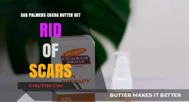Can Palmer's Cocoa Butter Effectively Fade and Heal Scars?