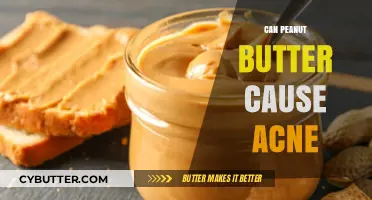 The Surprising Truth About Peanut Butter and Acne: What You Need to Know