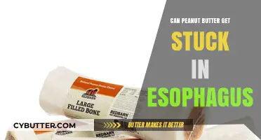 Peanut Butter in the Esophagus: Causes, Risks, and Remedies