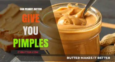 The Surprising Truth About Peanut Butter and Pimples