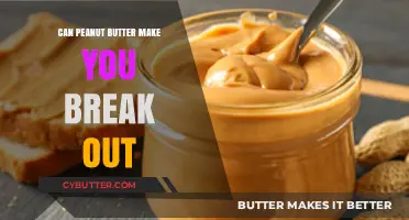 The Surprising Truth About Peanut Butter and Acne Breakouts