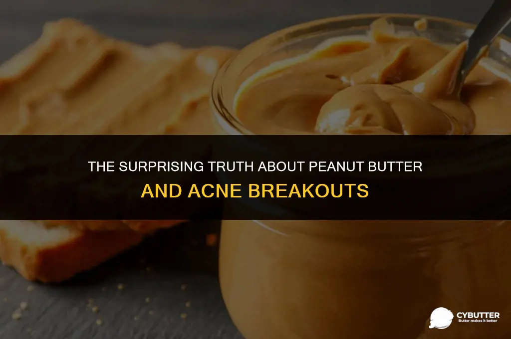 can peanut butter make you break out
