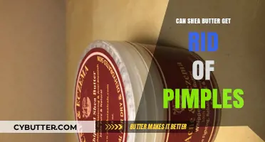 Shea Butter for Acne: Does It Clear Pimples Effectively?
