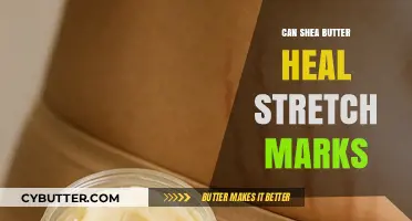 Nourishing Your Skin: The Healing Potential of Shea Butter for Stretch Marks