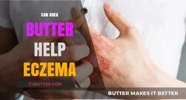 Nourishing Relief: How Shea Butter Soothes Eczema Symptoms