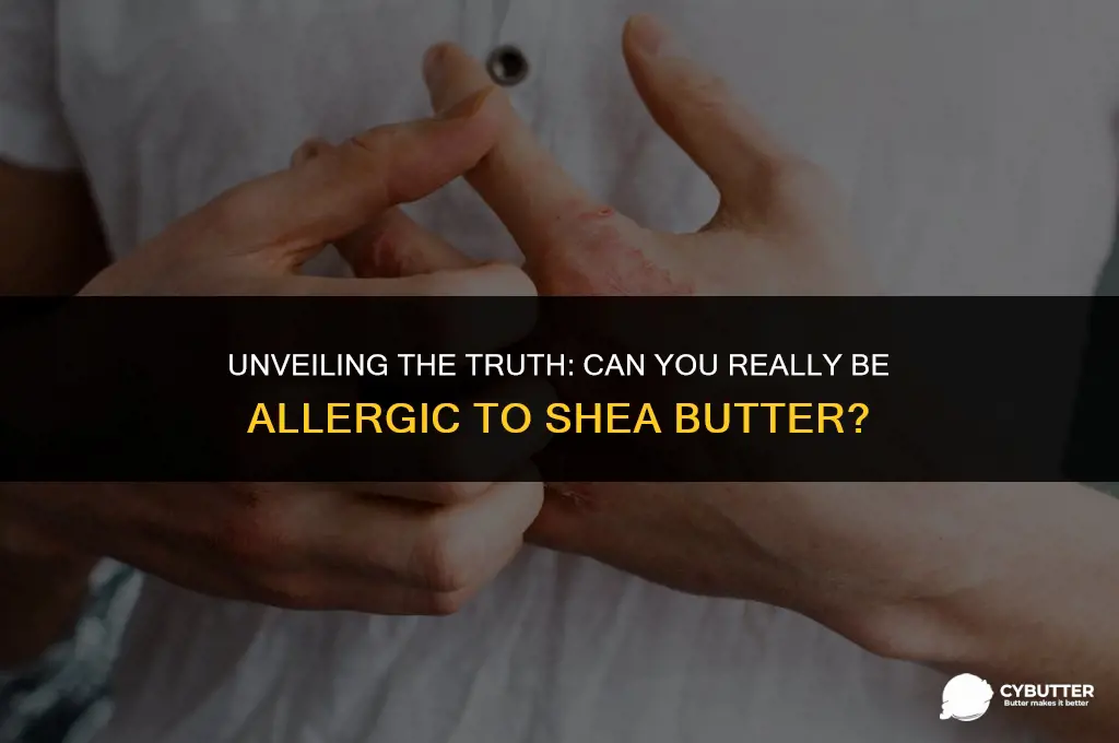can you be allergic to shea butter