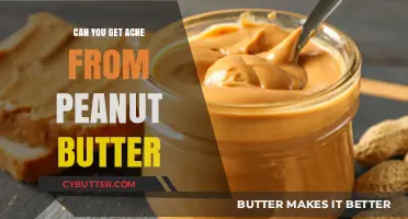 Peanut Butter and Acne: Uncovering the Truth Behind the Myth