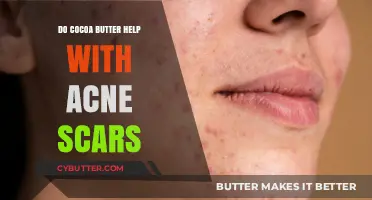 Cocoa Butter's Role in Healing Acne Scars: A Comprehensive Guide