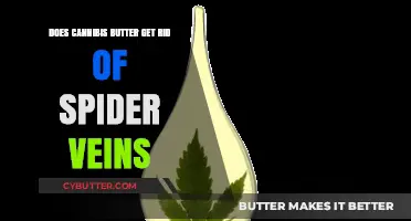 Cannabis Butter and Spider Veins: Myth or Effective Remedy?