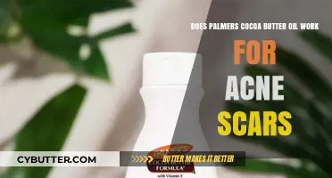 Palmer's Cocoa Butter Oil: Effective Remedy for Acne Scars?