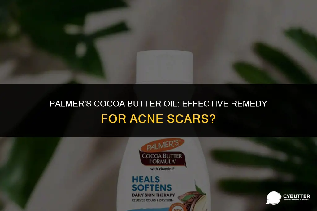 does palmers cocoa butter oil work for acne scars