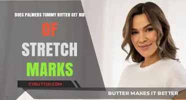 Can Palmer's Tummy Butter Effectively Remove Stretch Marks? Find Out
