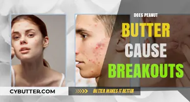 The Truth About Peanut Butter: Does It Really Cause Breakouts?