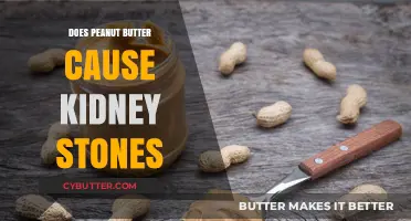 The Surprising Truth About Peanut Butter and Kidney Stones