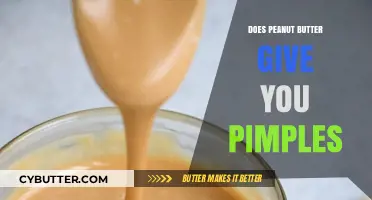 The Surprising Truth About Peanut Butter and Acne
