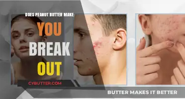 The Surprising Truth About Peanut Butter and Skin Breakouts