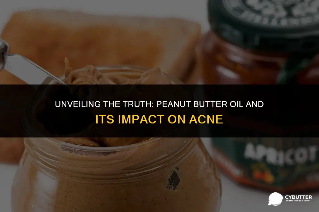 does peanut butter oil cause acne