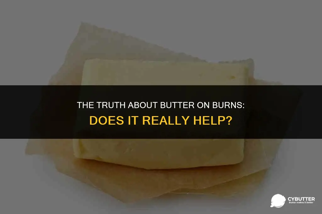 does putting butter on a burn help