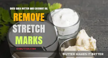 Nourishing Your Skin: Shea Butter and Coconut Oil for Stretch Marks?