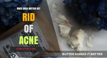 Shea Butter for Acne: Effective Solution or Just a Myth?