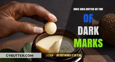 Shea Butter for Dark Marks: Effective Solution or Myth?