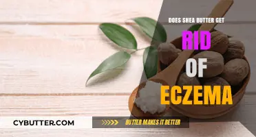 Can Shea Butter Effectively Soothe and Heal Eczema Symptoms?