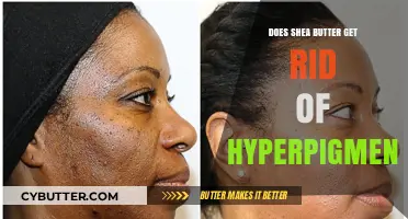 Shea Butter for Hyperpigmentation: Effective Solution or Myth?