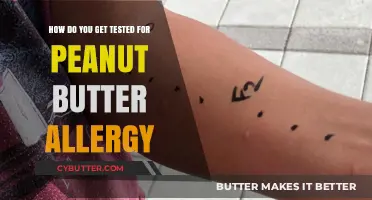 Peanut Butter Allergy Testing: Steps, Symptoms, and Safe Diagnosis