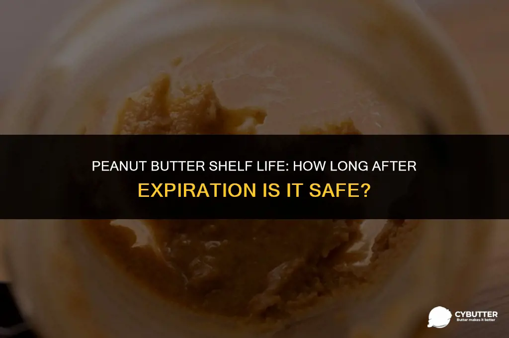 how long after expiration date peanut butter