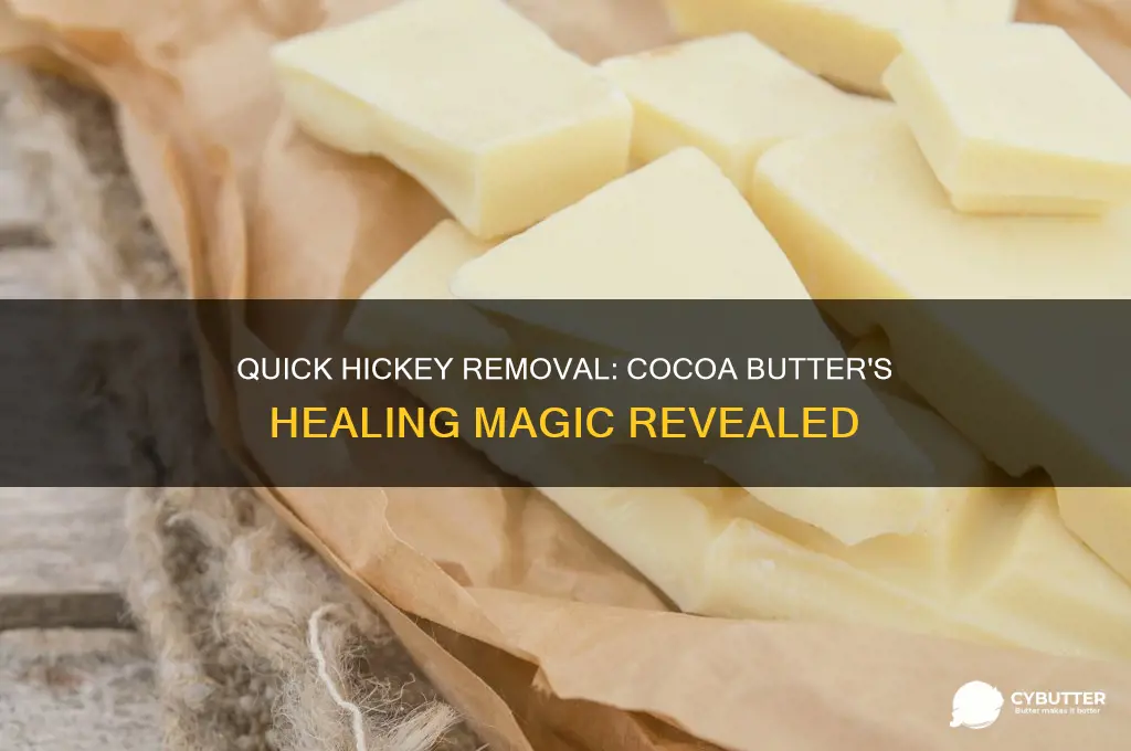 how to get rid of a hickey with cocoa butter