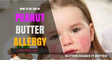 Overcoming Peanut Butter Allergies: Effective Strategies for Safe Consumption