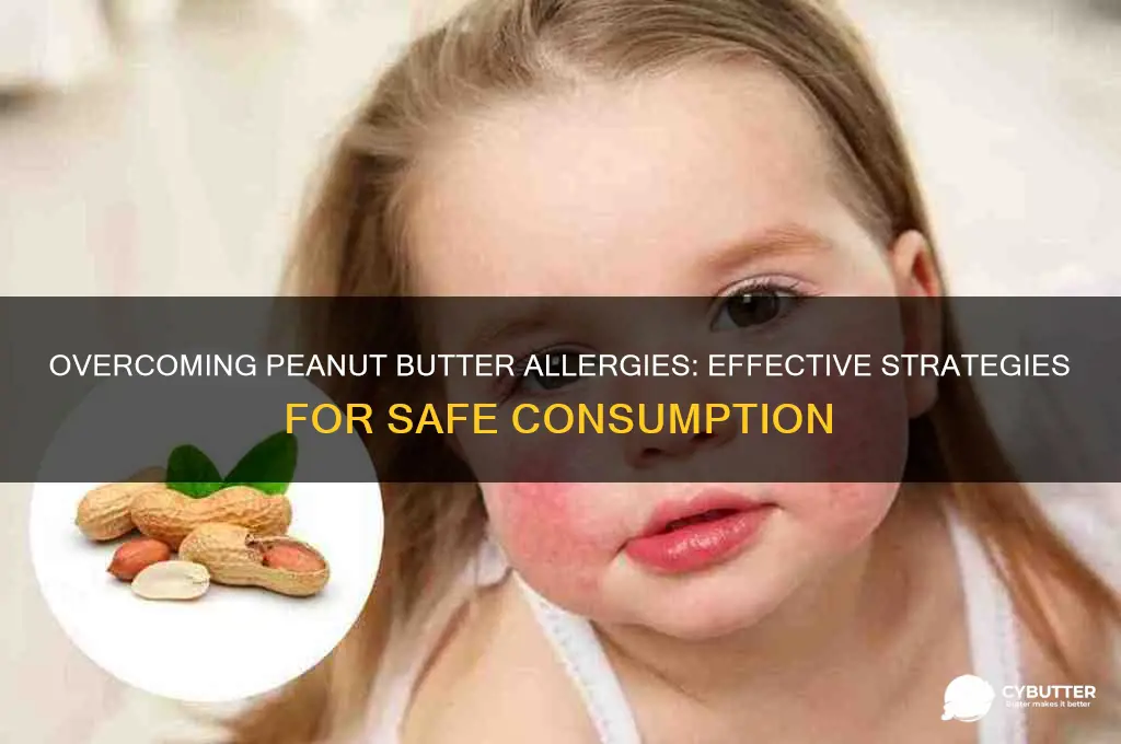 how to get rid of peanut butter allergy