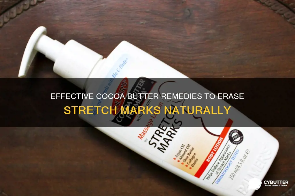 how to get rid of stretch marks cocoa butter