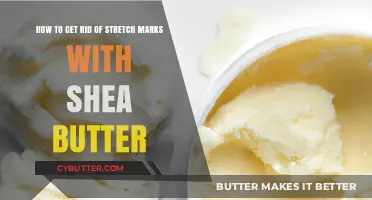 Effective Shea Butter Remedies to Erase Stretch Marks Naturally