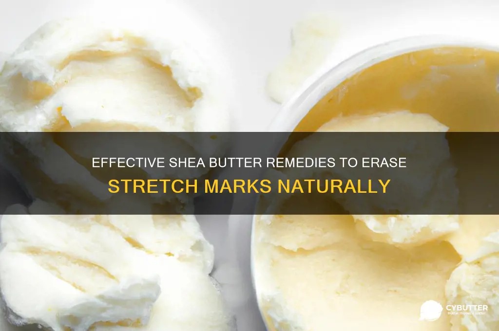 how to get rid of stretch marks with shea butter