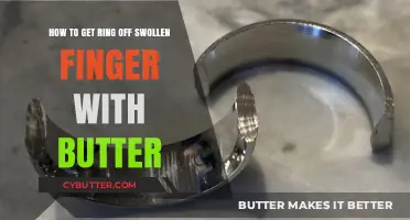 Butter to the Rescue: Removing a Ring from a Swollen Finger