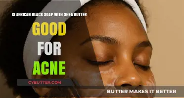 African Black Soap with Shea Butter: Effective Acne Treatment?